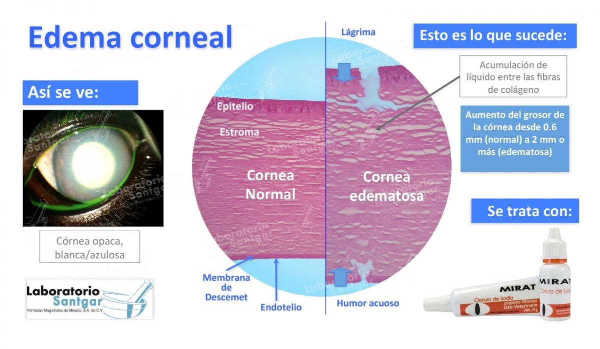 edema-corneal-laboratorio-santgar