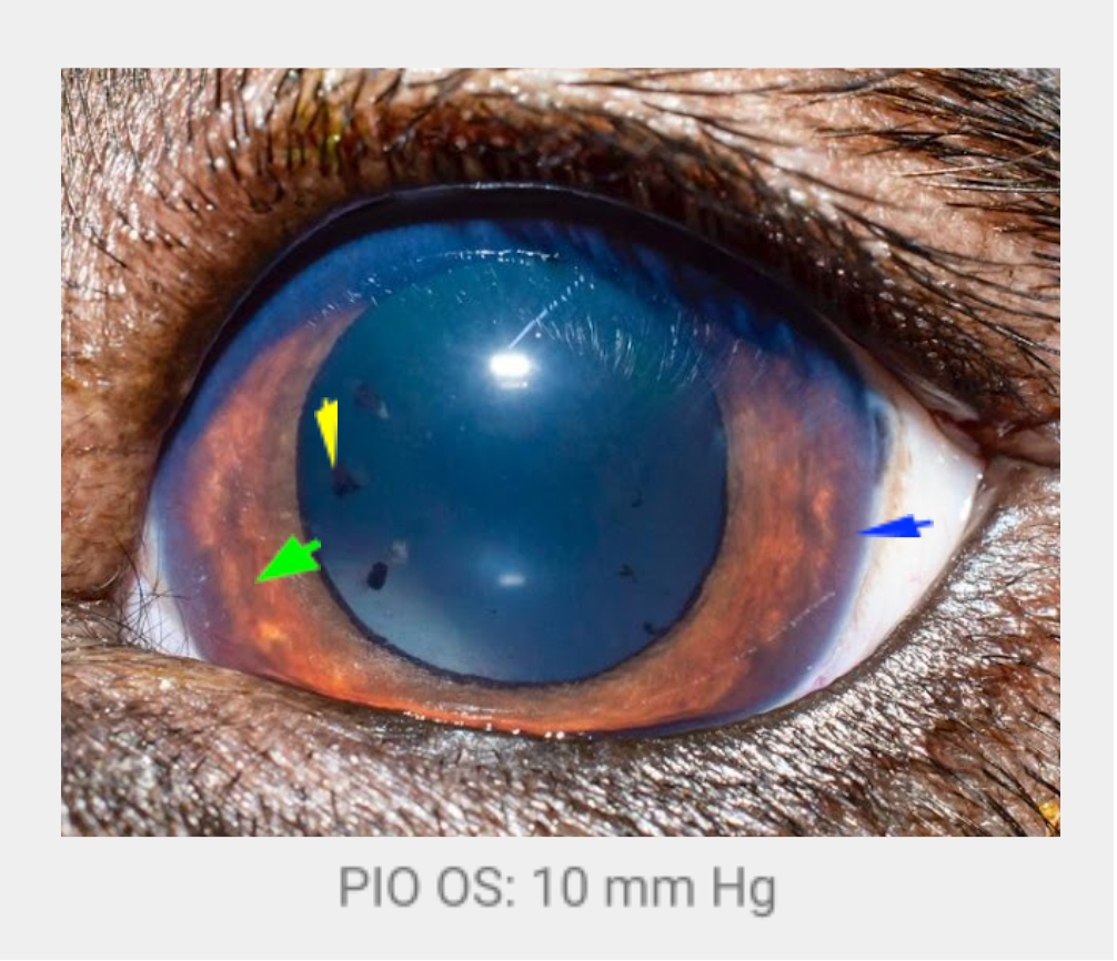 Ojo izquierdo
